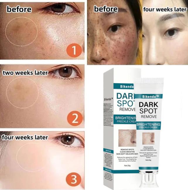 The Bikenda  Beauty Cream - Fade Spots & Wrinkles, Fast + 50% OFF