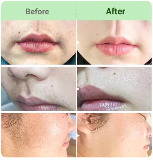 DermaSmooth - Silky-Smooth Skin, Zero Irritation - 50% OFF