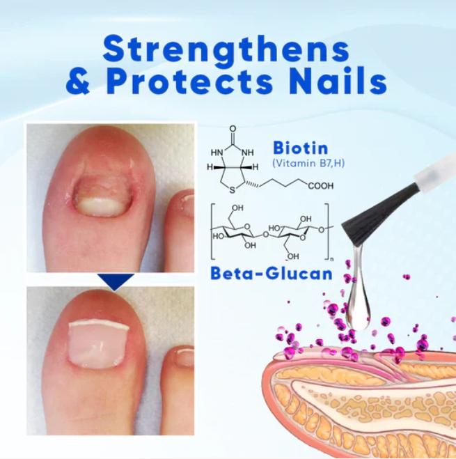 OnyxoGuard Serum - Stronger Nails in 2 Weeks + 50% OFF