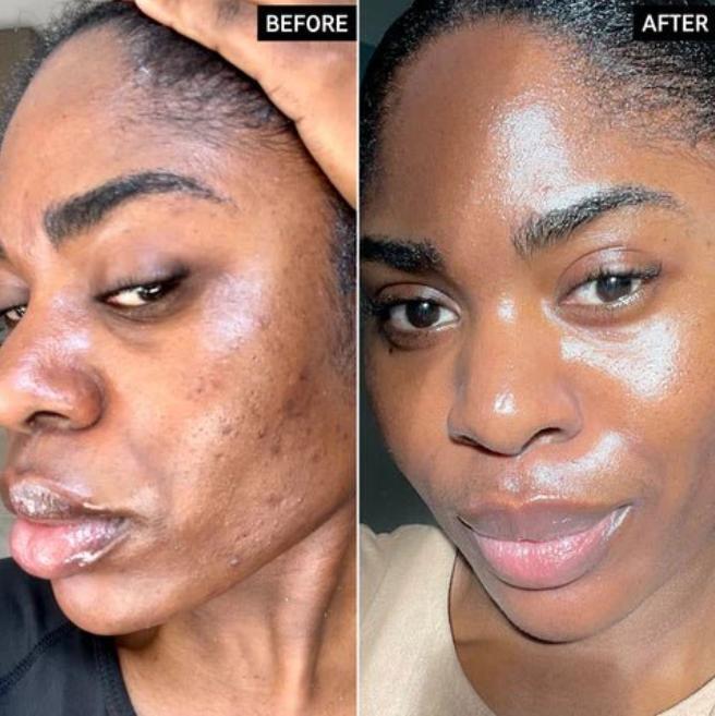 The TurmericGlow Cleansing Pads - Kojic Acid & Turmeric for Brightening, Anti-Aging, and Dark Spot Reduction + 50% OFF