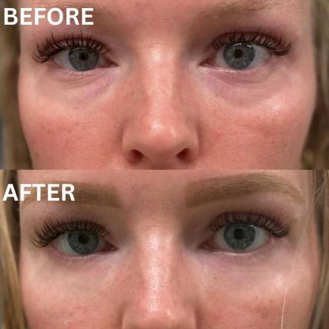 CryoGlow Patches - A Camera-Ready Look in 60 Minutes - 50% OFF