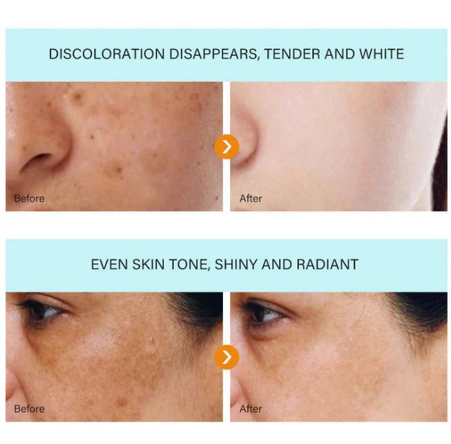The Bikenda  Beauty Cream - Fade Spots & Wrinkles, Fast + 50% OFF