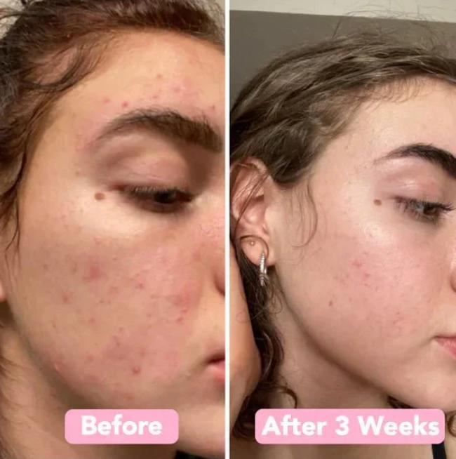 The TurmericGlow Cleansing Pads - Kojic Acid & Turmeric for Brightening, Anti-Aging, and Dark Spot Reduction + 50% OFF