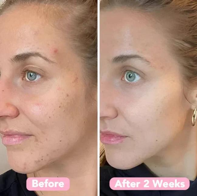 The TurmericGlow Cleansing Pads - Kojic Acid & Turmeric for Brightening, Anti-Aging, and Dark Spot Reduction + 50% OFF