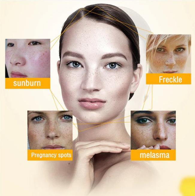 The Bikenda  Beauty Cream - Fade Spots & Wrinkles, Fast + 50% OFF