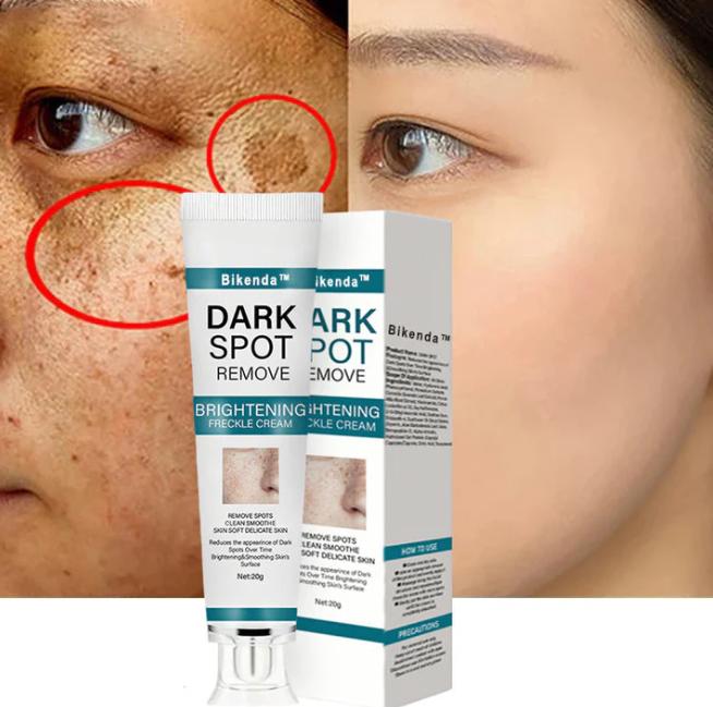 The Bikenda  Beauty Cream - Fade Spots & Wrinkles, Fast + 50% OFF