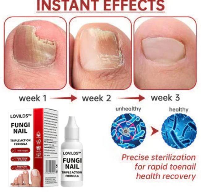FungaClear Triple-Action Nail Repair - Clear Nails, Renewed Confidence + 1+1 FREE