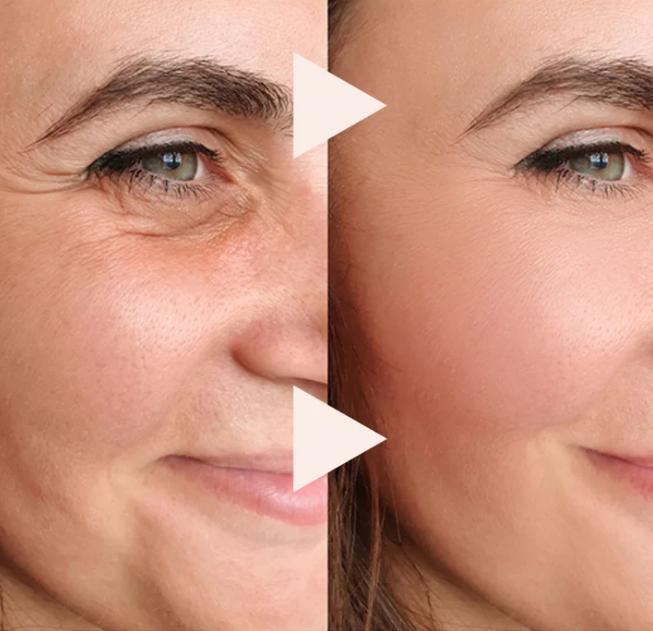 Wrinkle Eraser ¨C An Instant Lift in a Stick + 50% OFF