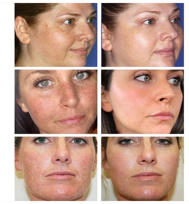The Bikenda  Beauty Cream - Fade Spots & Wrinkles, Fast + 50% OFF