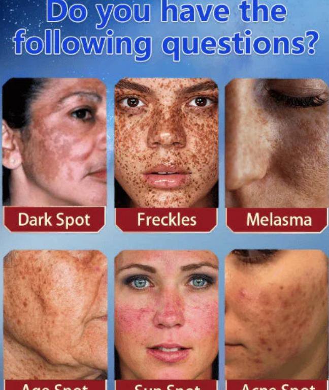 The Bikenda  Beauty Cream - Fade Spots & Wrinkles, Fast + 50% OFF