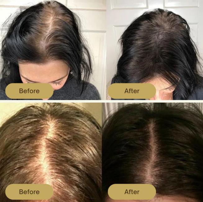 FolliPrime Synergy Oil - Achieve Visibly Thicker, Fuller Hair and Renewed Confidence - 1 + 1 FREE