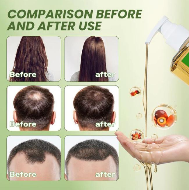 Newyuo Batana Oil & Rosemary Shampoo - The Secret to Fuller, Healthier Hair + 1+1 FREE