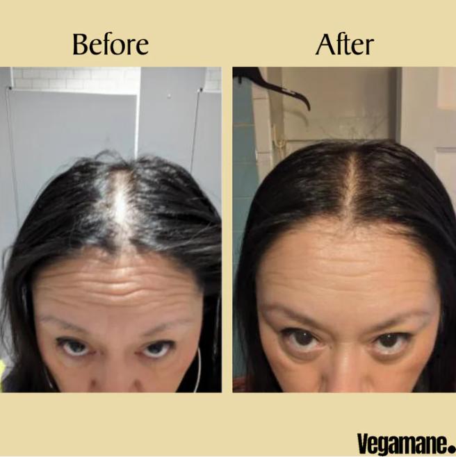 FolliRoot C Regrow thicker, fuller hair. + 50% OFF