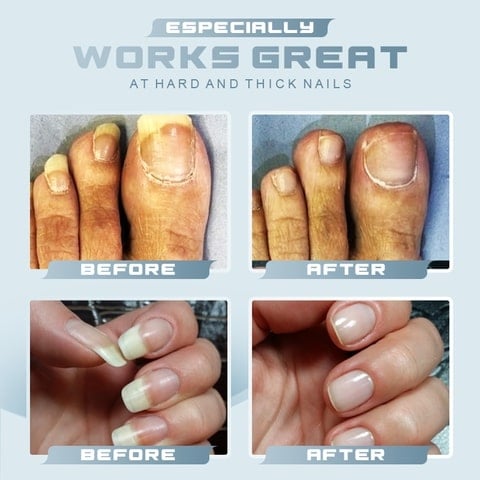 The TitanGrip Clipper - Cut the Toughest Nails, Effortlessly - 50% OFF