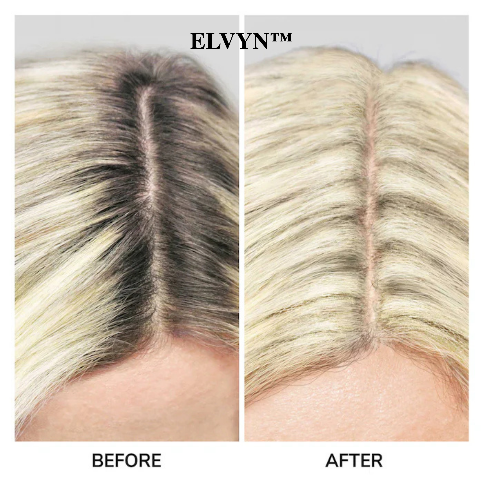 ElvynRoot - Flawless Hair Roots Instantly - 50% OFF