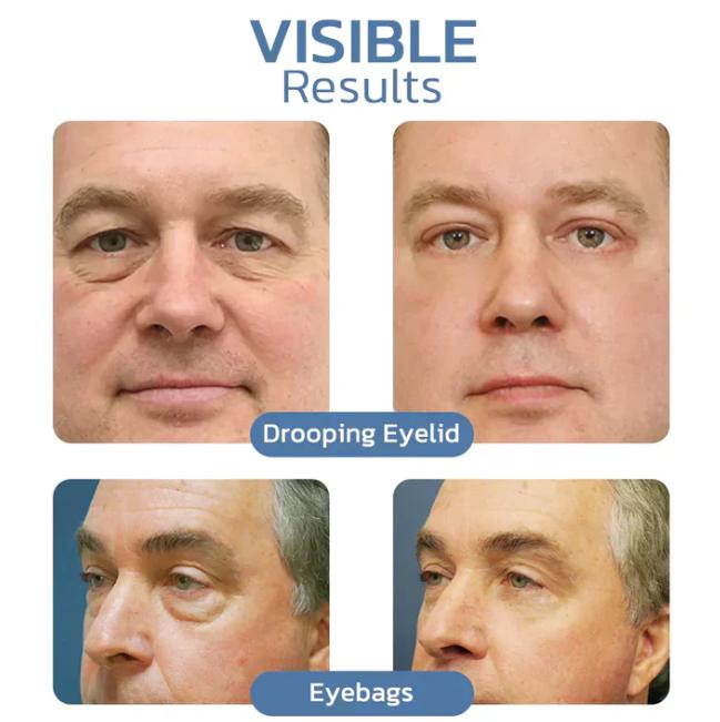 Awaken Peptide Lifting Eye Gel - A Visible Eye Lift in a Jar + 50% OFF