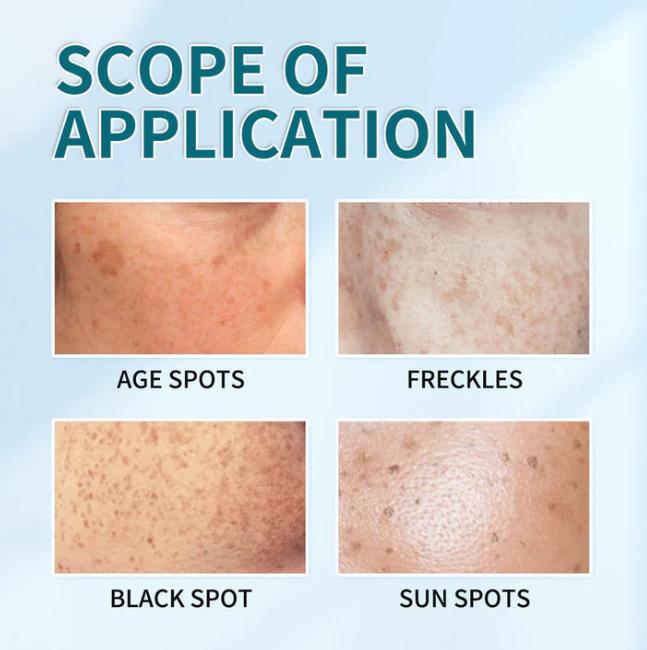 The Bikenda  Beauty Cream - Fade Spots & Wrinkles, Fast + 50% OFF