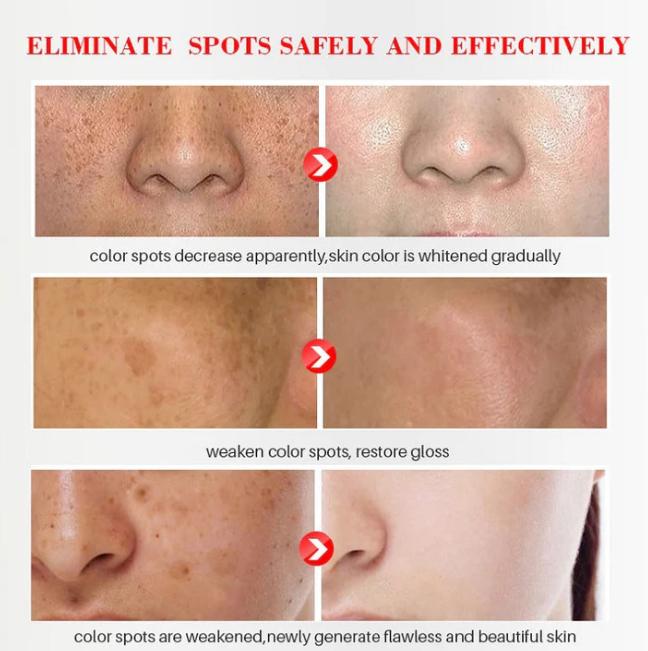 The Bikenda  Beauty Cream - Fade Spots & Wrinkles, Fast + 50% OFF