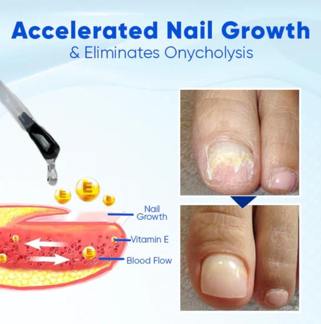 OnyxoGuard Serum - Stronger Nails in 2 Weeks + 50% OFF