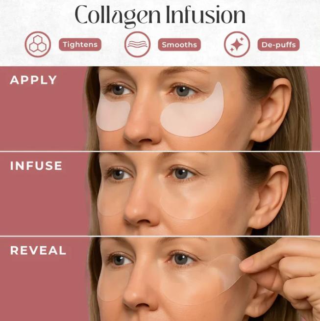 CryoGlow Patches - A Camera-Ready Look in 60 Minutes - 50% OFF