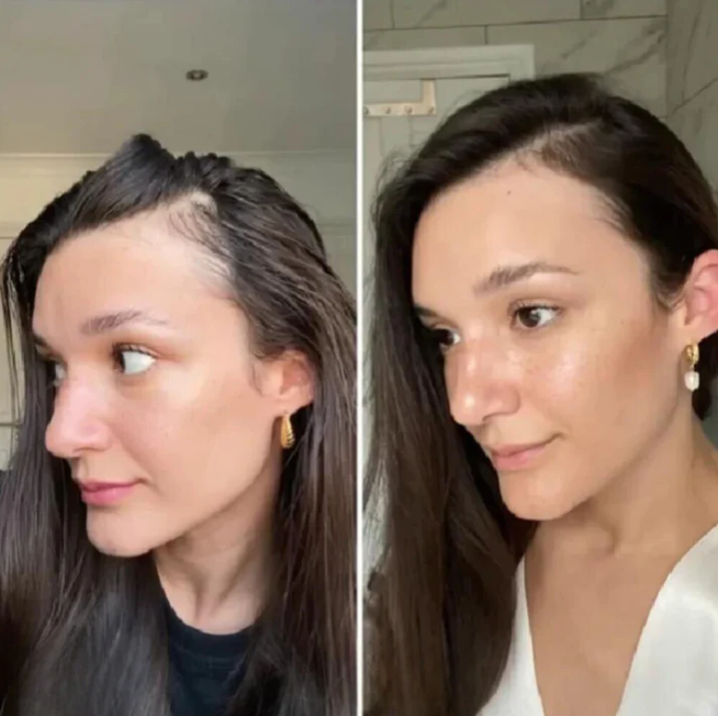 The EELHOE Natural Growth Oil - Rosemary, Castor, and Green Coffee for Thicker, Fuller Hair +  50% OFF