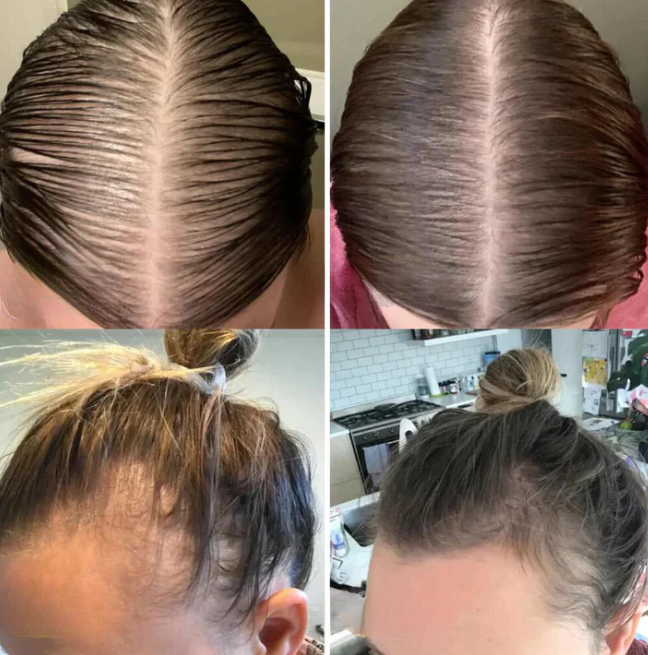 The EELHOE Natural Growth Oil - Rosemary, Castor, and Green Coffee for Thicker, Fuller Hair +  50% OFF