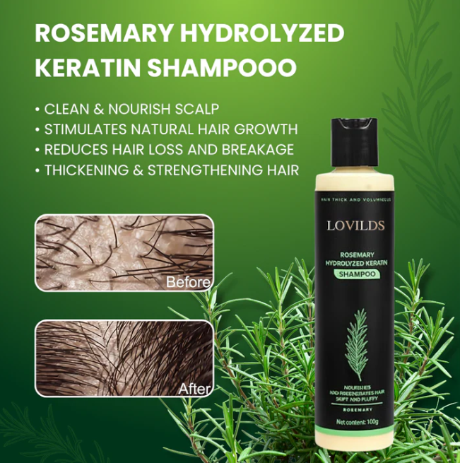 LOVILDS Rosemary Keratin ¨C Grow Thicker, Fuller Hair ¨C 50% OFF